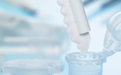 Hormone im Speichel – Hormonberatung in Zürich
